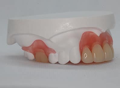 Affordable Dental Dentures and Partials in Jacksonville FL