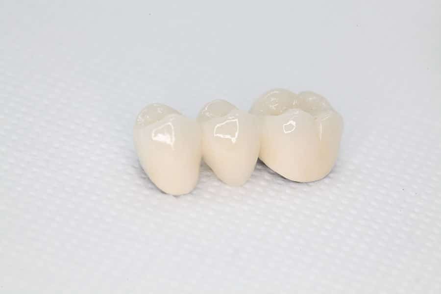 Jacksonville Dentist Teeth Whitening