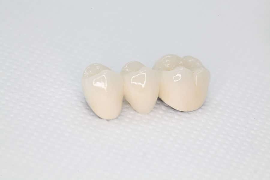 Jacksonville Dentist Teeth Whitening